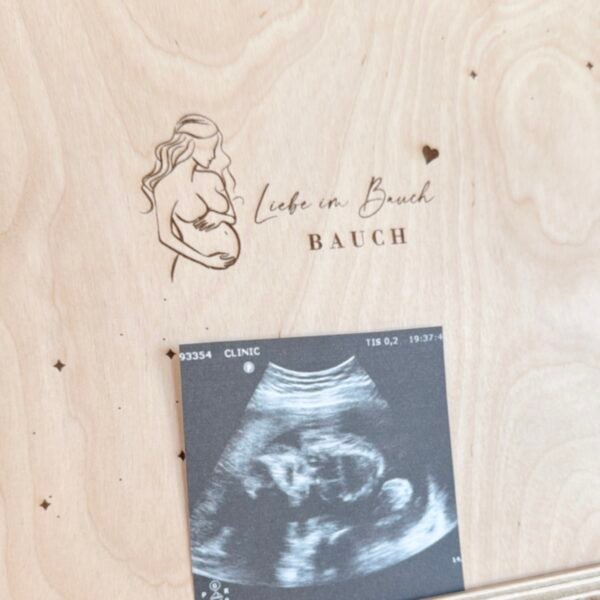 Erinnerungsbox zur Schwangerschaft | personalisiert – Bild 3